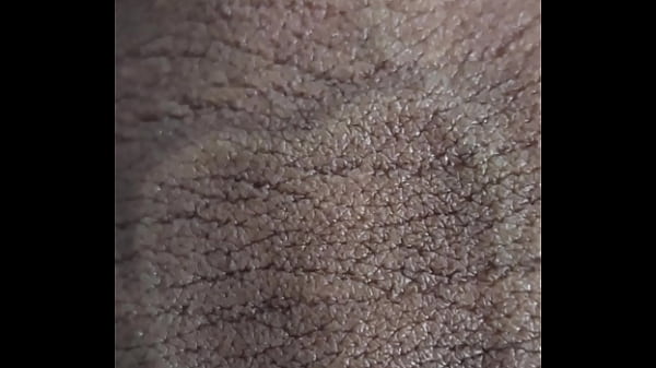 WHAT ARE THESE STAINS ON MY PENIS? A CLOSE CLOSE